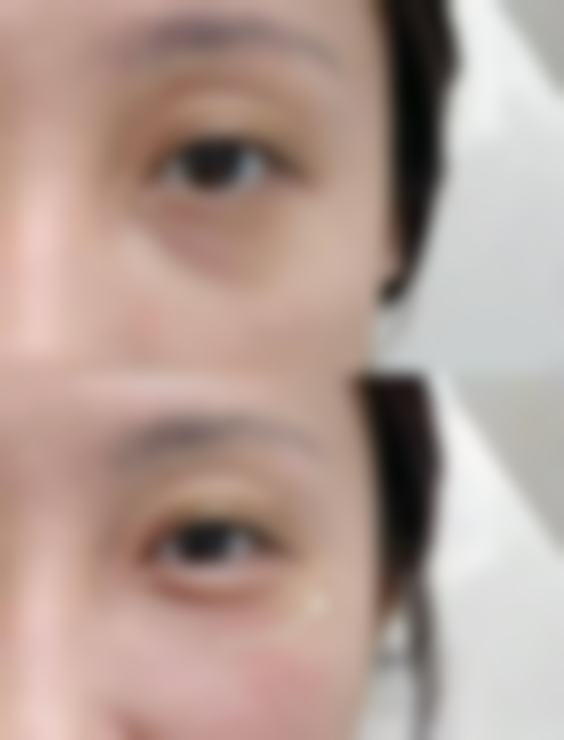 不同医美项目价格参考