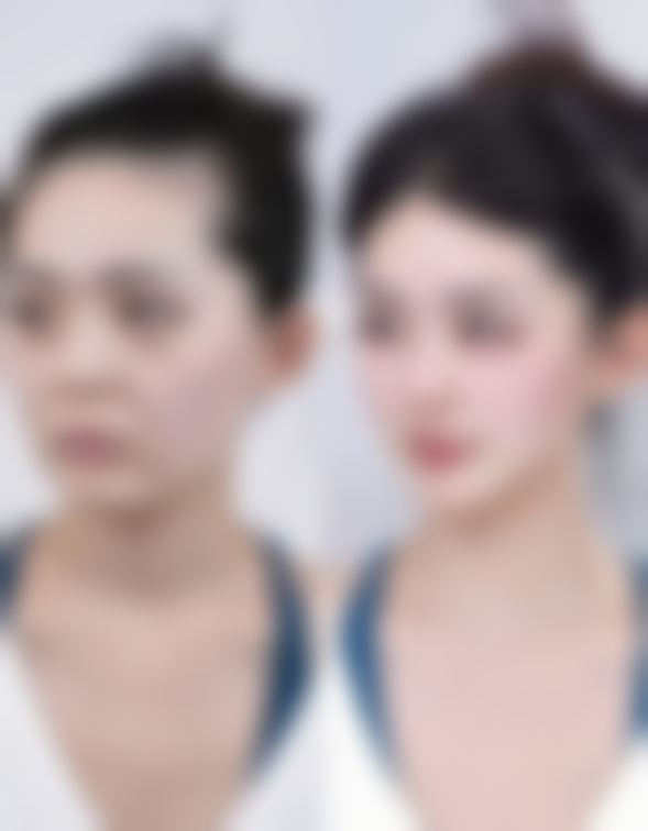 【绍兴颜莳整形医院特色项目：】