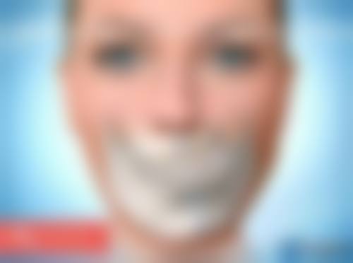 小阴唇缩小手术的方法