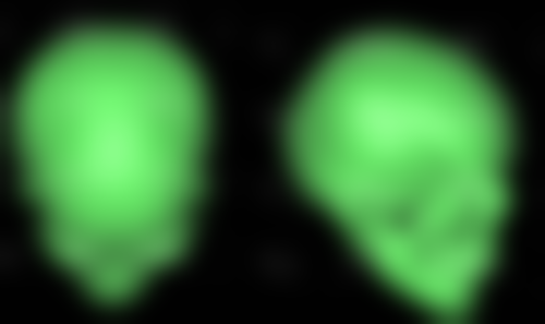 毛发种植有什么副作用