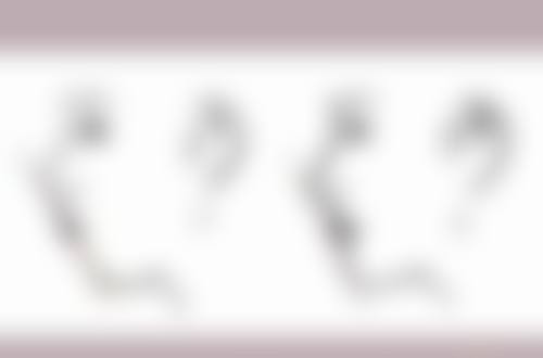 毛发种植的利弊