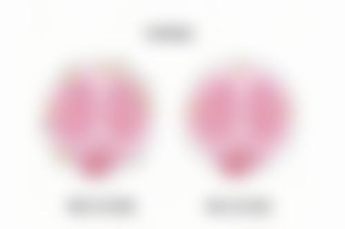 进行发际线种植的注意事项和术后维护建议