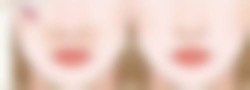 全脸除皱多久打一次