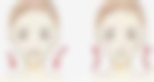 【上饶丰艺医疗美容门诊部是正规的吗?】