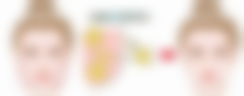 边缘弧形切除法