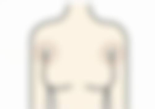 瘦脸针一般打50单位还是100单位