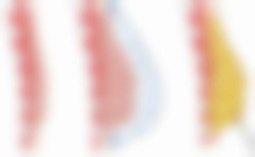 发际线种植能维持多久