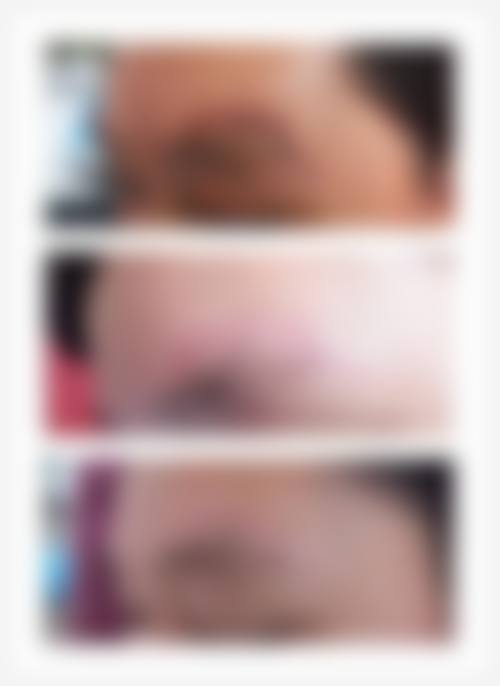 【上饶丰艺医疗美容门诊部参考价格表：】