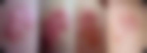 【韩国来丽整形医院患者口碑评价：】