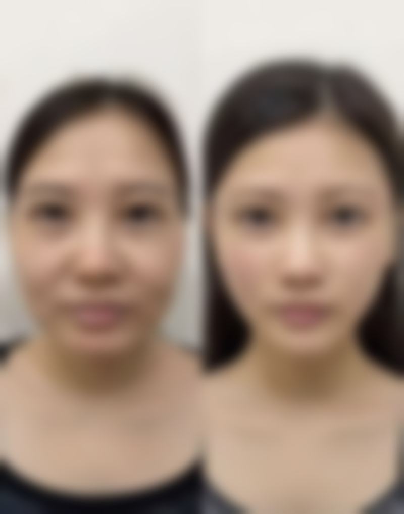 环切包皮手术挂什么科？权威解答告诉你男科、泌尿外科最全选择，为你手术顺利进行护航！ 