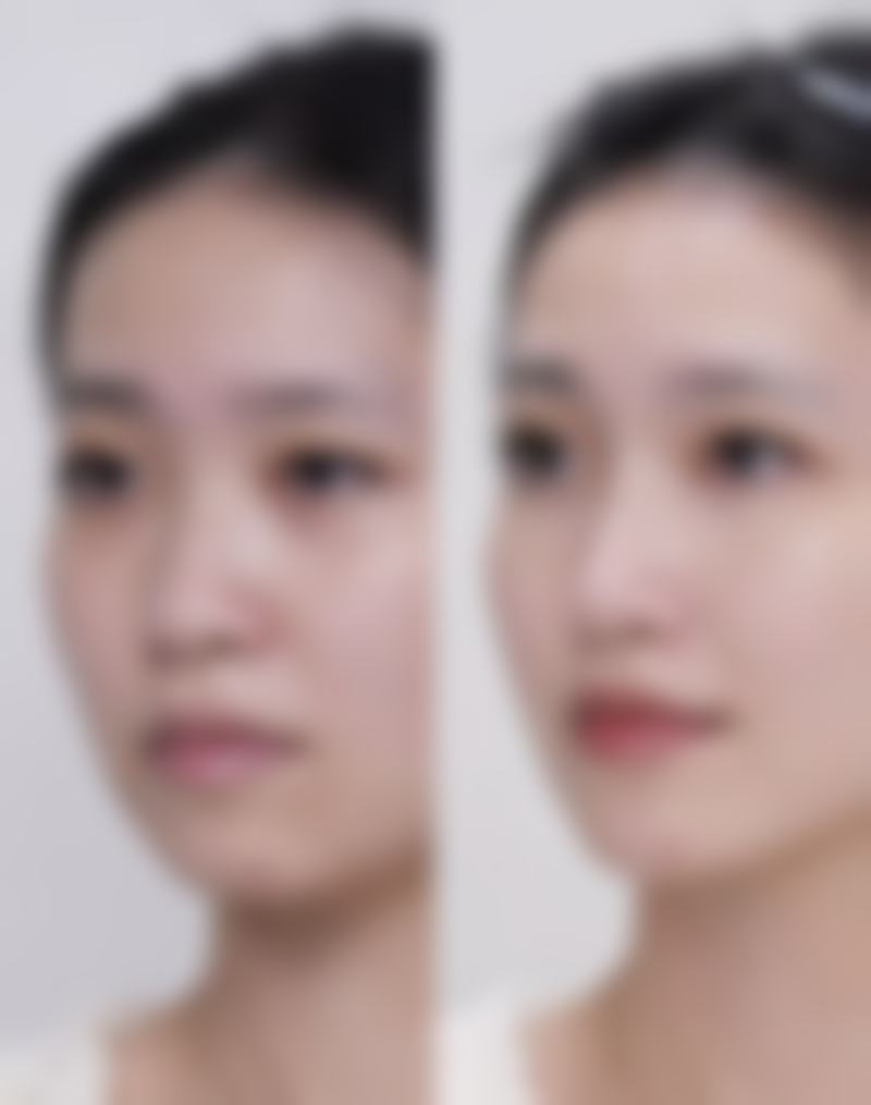 【郑州芳艺医疗美容核心优势：】