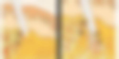 植发价格:发旋加密与发际线植发对比