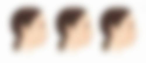 脸上除皱一般都打的什么针?