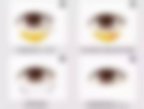 瘦脸针多少钱一次,打几次定型