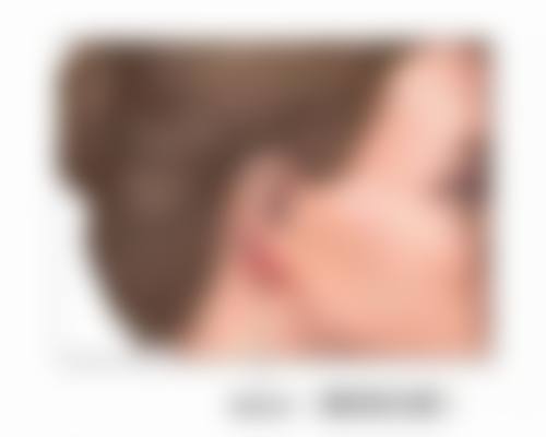 胖的时候打瘦脸针好,还是瘦的时候打