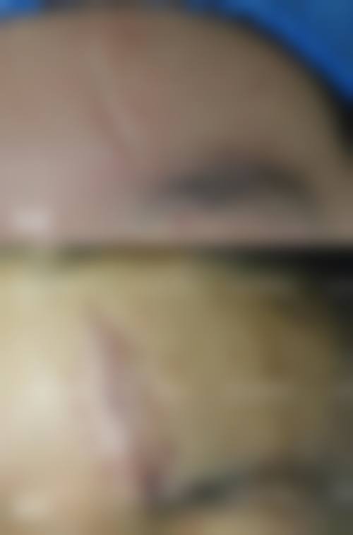 【广州尚美善造美容医院诊疗设备：】