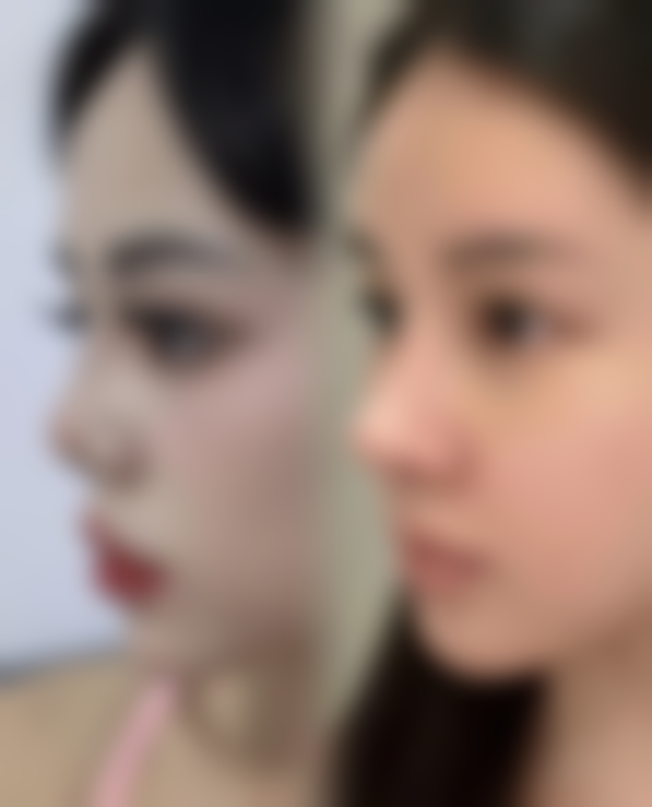 【广州尚美善造美容医院是正规的吗?】