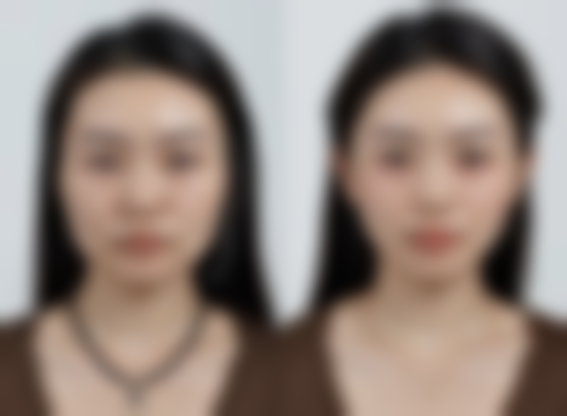 晒黑了用美白产品有用吗