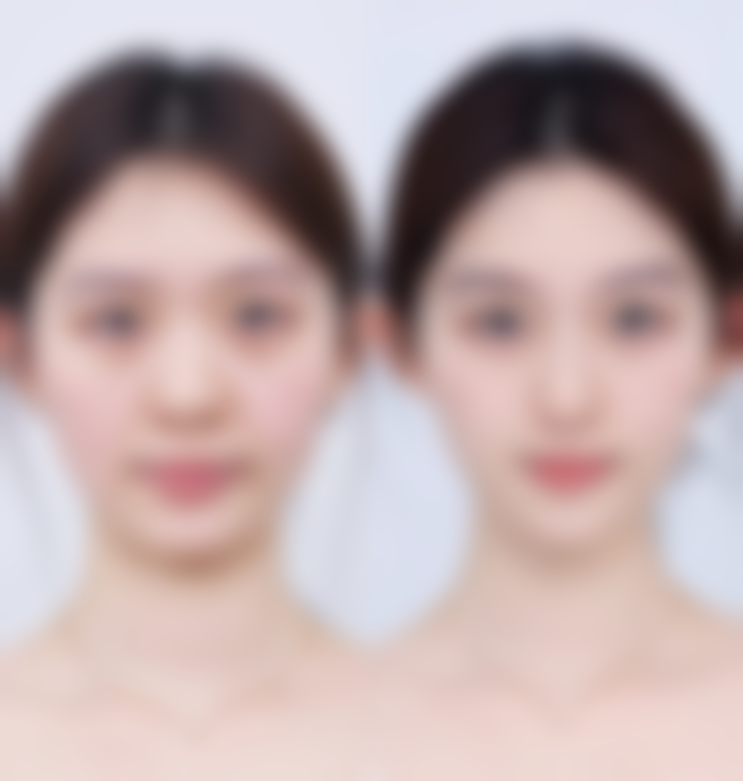 【深圳依美整形美容门诊部是正规的吗?】