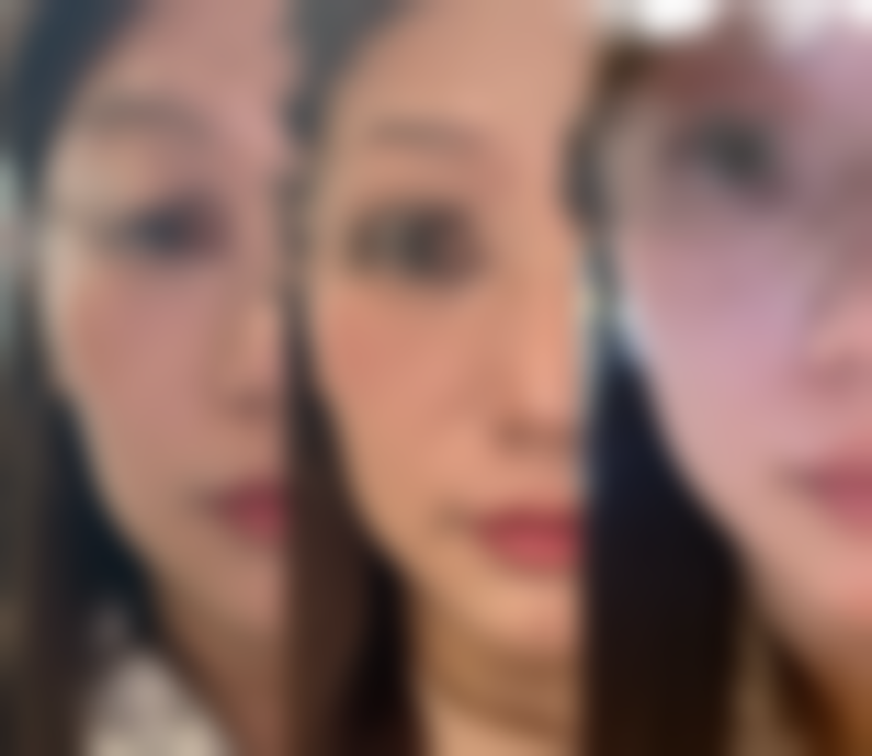 【广州尚美善造美容医院参考价格表：】