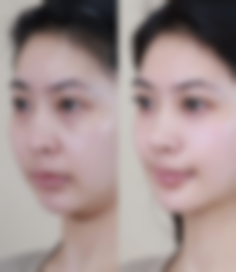 晒黑打美白针有用吗女生