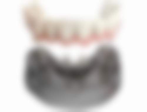 种植头发能维持几年