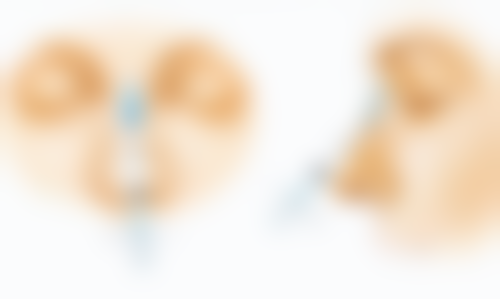 美白针影响以后生育吗