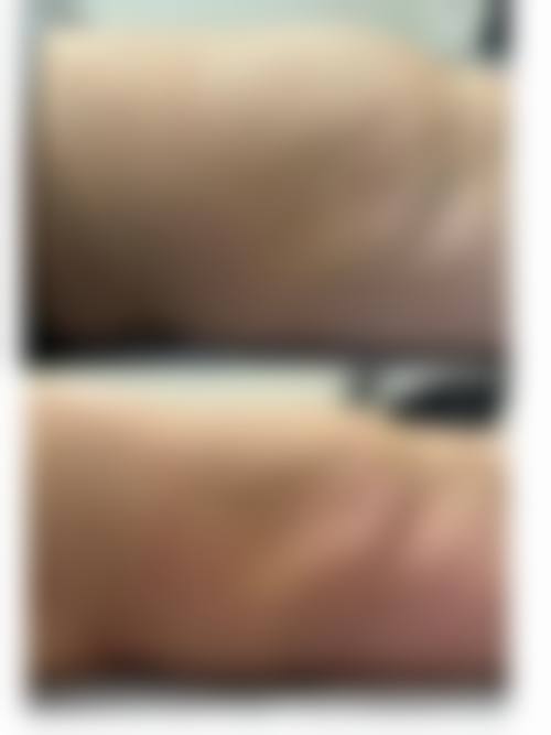 【上海颜之梦整形医疗美容门诊部参考价格表：】