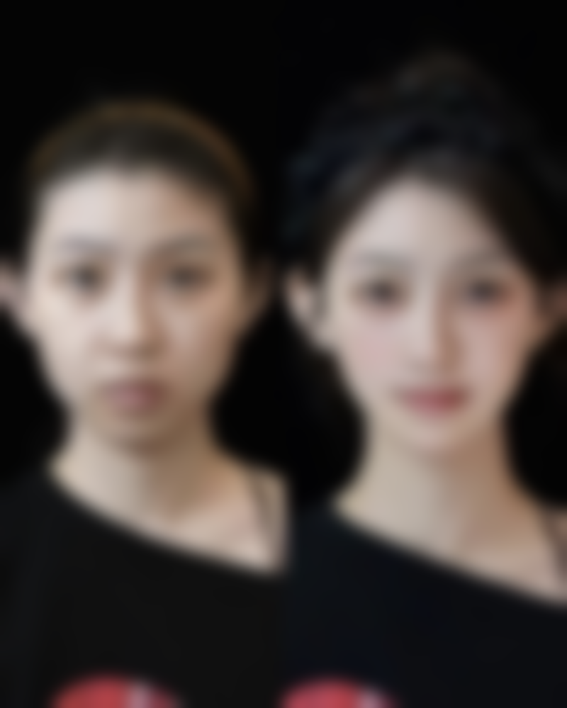 牙齿整形的好处