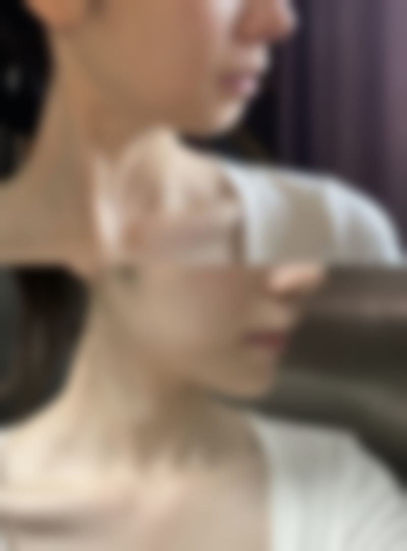 美白针会影响生育吗