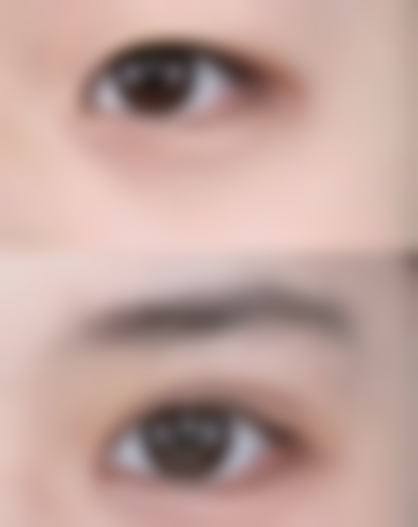 【解放军155整形美容医院参考价格表:】