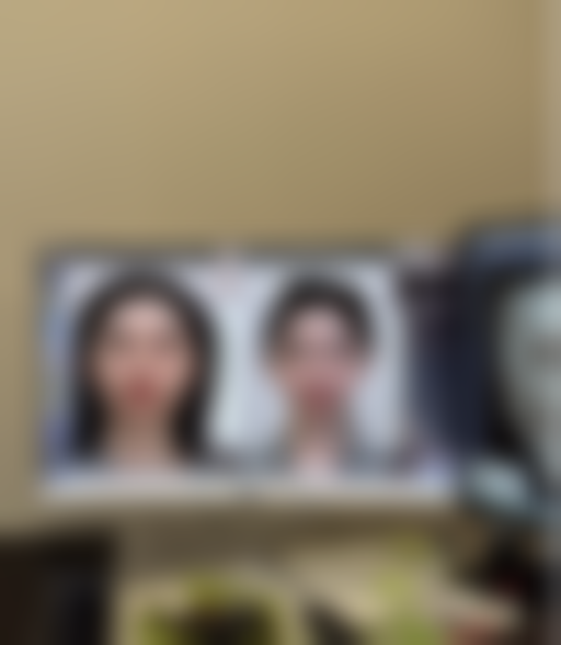 牙齿磨损的病因、分类及修复重建治疗进展