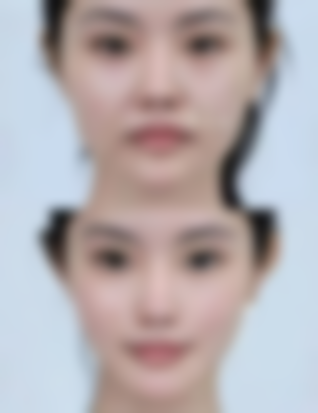 【Kalon美容诊所特色项目：】