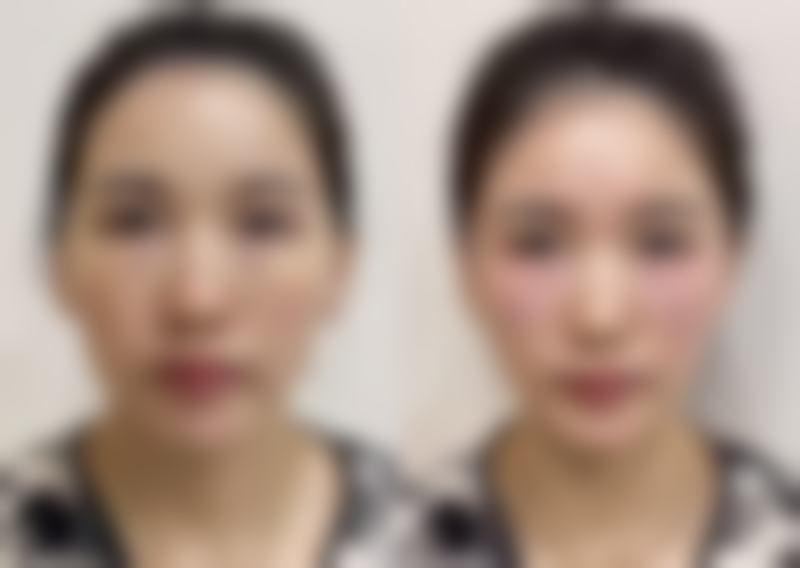 【北京雅韵整形医疗美容患者口碑评价:】