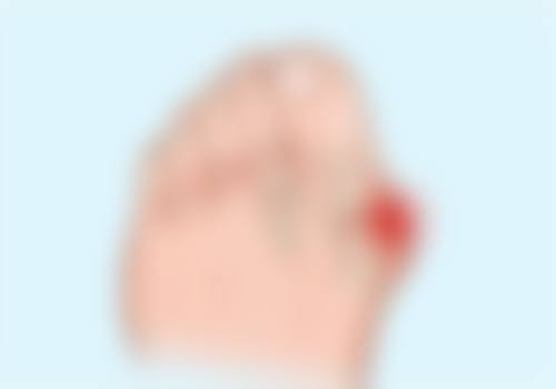 头发种植对人体有害吗？权威揭秘：正规操作下头发种植益处多，还可改善 90%脱发困扰！ 