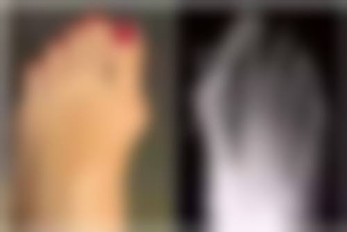 种植头发的好处