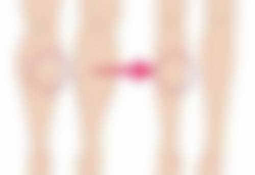 如何选择适合自己的丰太阳穴方法