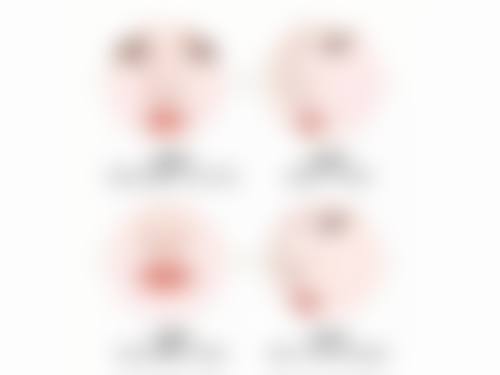 济南省立医院激光美容科丰太阳穴价格及优势