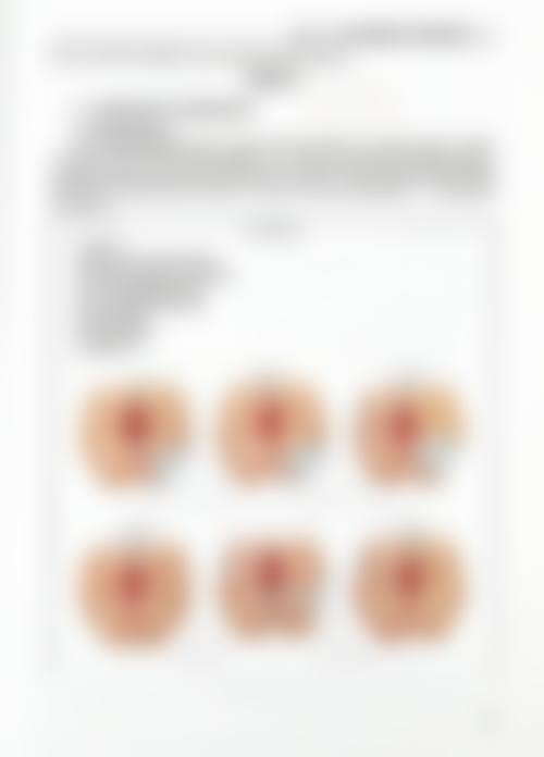 四川成都美容整形医院私密科阴道紧缩手术(重度)实例分享