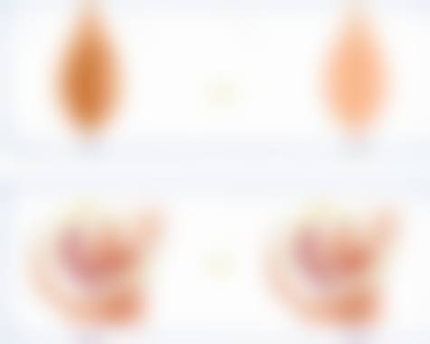 四川成都美容整形医院私密科阴道紧缩手术(重度)预约挂号方式