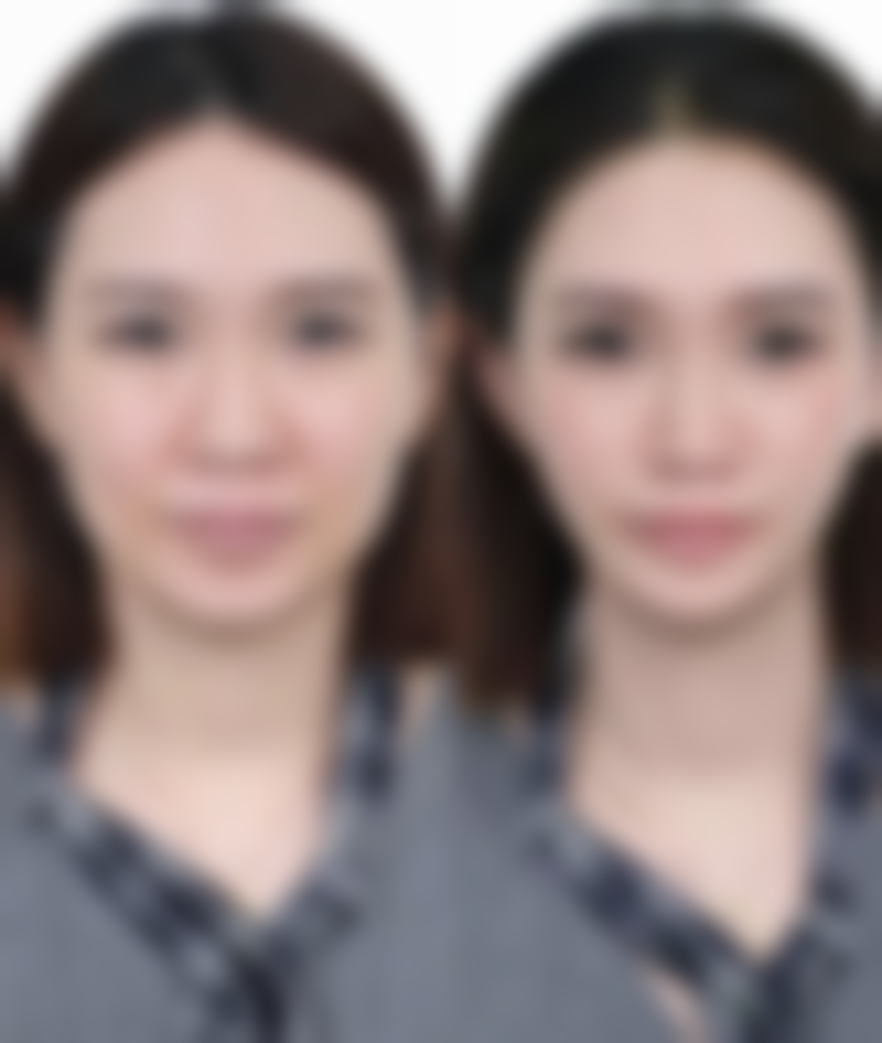 美白针成分有哪些药