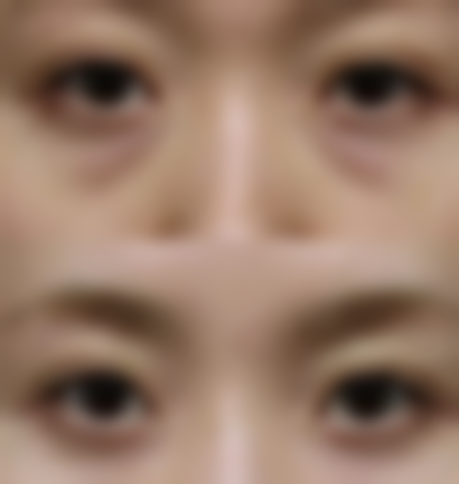 【北京秀中皮肤健康整形医疗中 心参考价格表:】