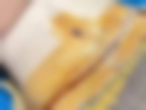 瘦脸针什么时候开始起效