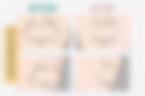 怎么种植头发那么贵