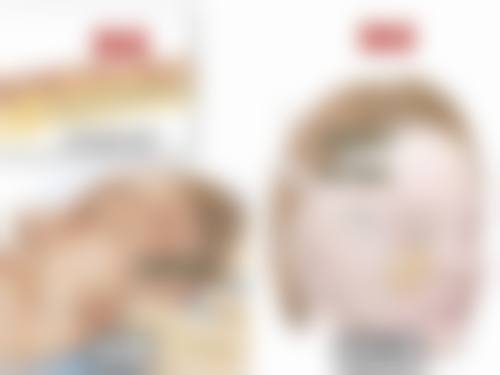 面上、中1/3皮肤松弛面部除皱术式选择