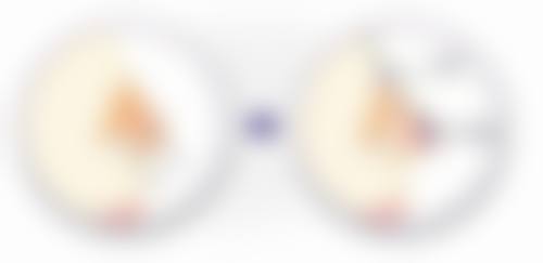 打了瘦脸针能维持多久？