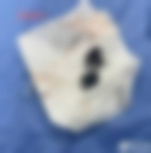 【沈阳小树医疗美容设备与技术】