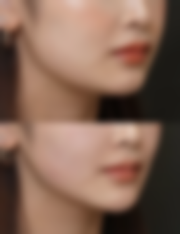 除皱针跟瘦脸针都是肉毒素吗