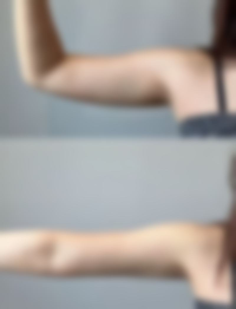 瘦脸针什么时候打比较好？揭秘最佳注射时段，让你3个月快速拥有小V脸，效果超惊艳！ 