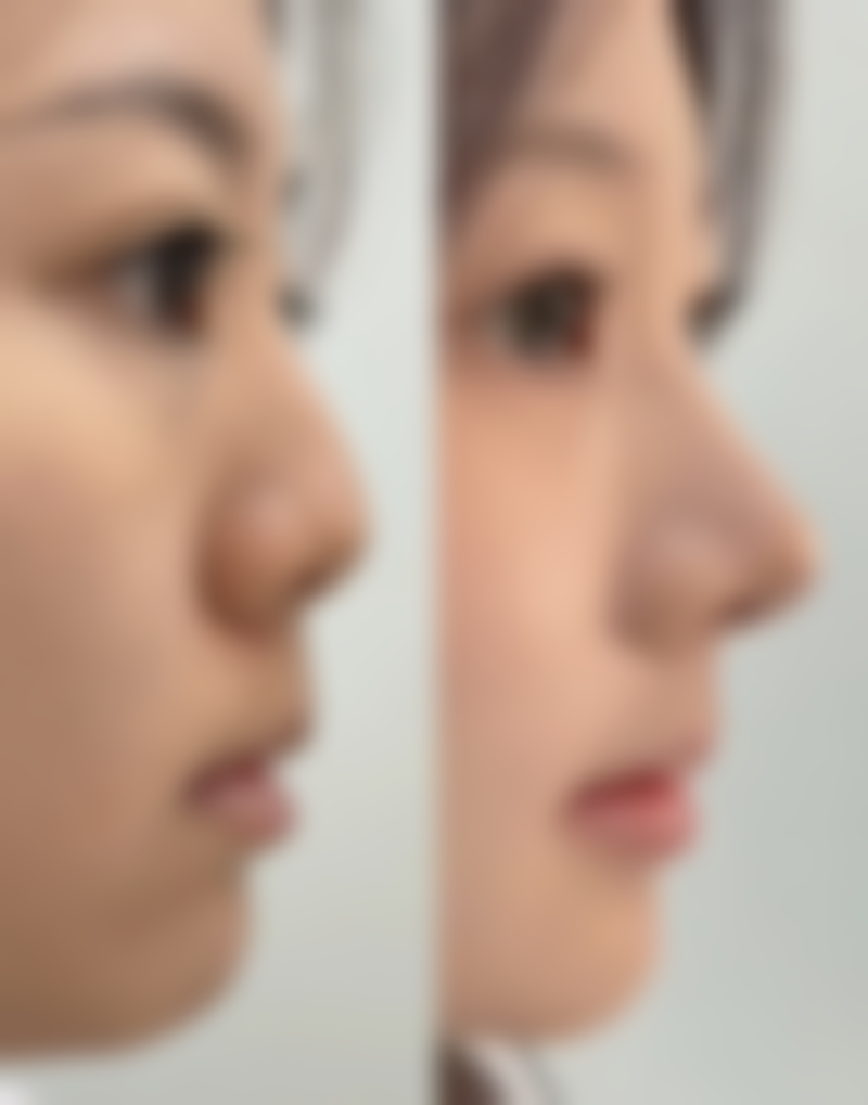 从患者的角度来看，有不少正向的评价。有患者说：“在武汉万丽整形医院做了眼部整形手术，成效超出了我的预期，医生的技术非常好，而且术后的修复也特别顺利，现在我的眼睛变得又大又亮，真的太满意了。”还有患者评价：“医院的服务特别贴心，从询问到手术再到术后护理，每一个环节都有人跟进，让我感觉特别安心。我做的面部填充项目，现在脸部看起来饱满又自然，就像年轻了好几岁。”另外一位患者也分享道：“我来这里做皮肤护理，设备特别精良，医生和护士都特别专精，每次做完护理，皮肤都变得水润有光泽，真的是一家值得信赖的医美医院。”